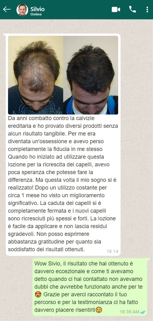 Prima e dopo trattamento contro la calvizie con risultati visibili.