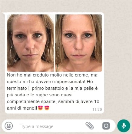 Prima e dopo trattamento viso, pelle più liscia e luminosa.