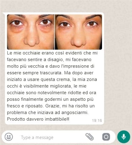 Prima e dopo trattamento occhi con crema naturale, occhi più freschi e riposati.