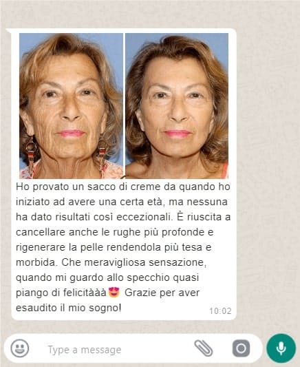 Donna anziana con pelle più liscia e giovane dopo crema antirughe.