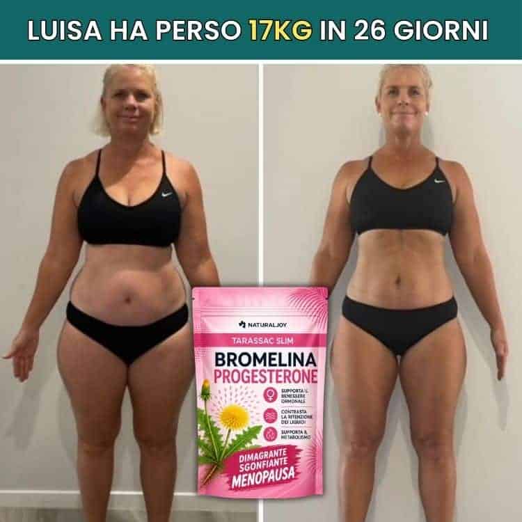 Luisa prima e dopo la perdita di 17kg in 26 giorni con Tarassaco Slim.