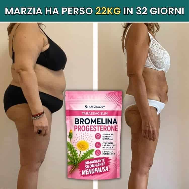 Donna prima e dopo la perdita di peso con Tarassaco Slim.