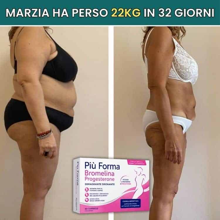 Donna prima e dopo perdita peso di 22kg in 32 giorni.